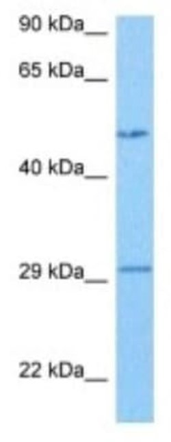 CYP7A1 Rabbit anti-Human, Polyclonal, Novus Biologicals 100 &mu;g; Unconjugated:Antibodies,